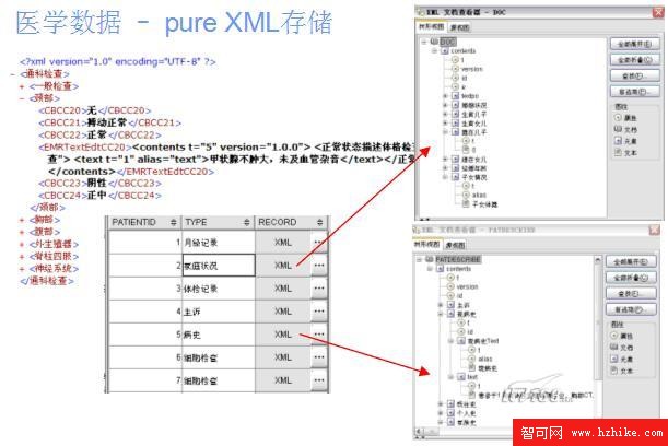 DB2 purexml(標准化越來越近了)如何應對新一代數據庫技術挑戰（圖八）